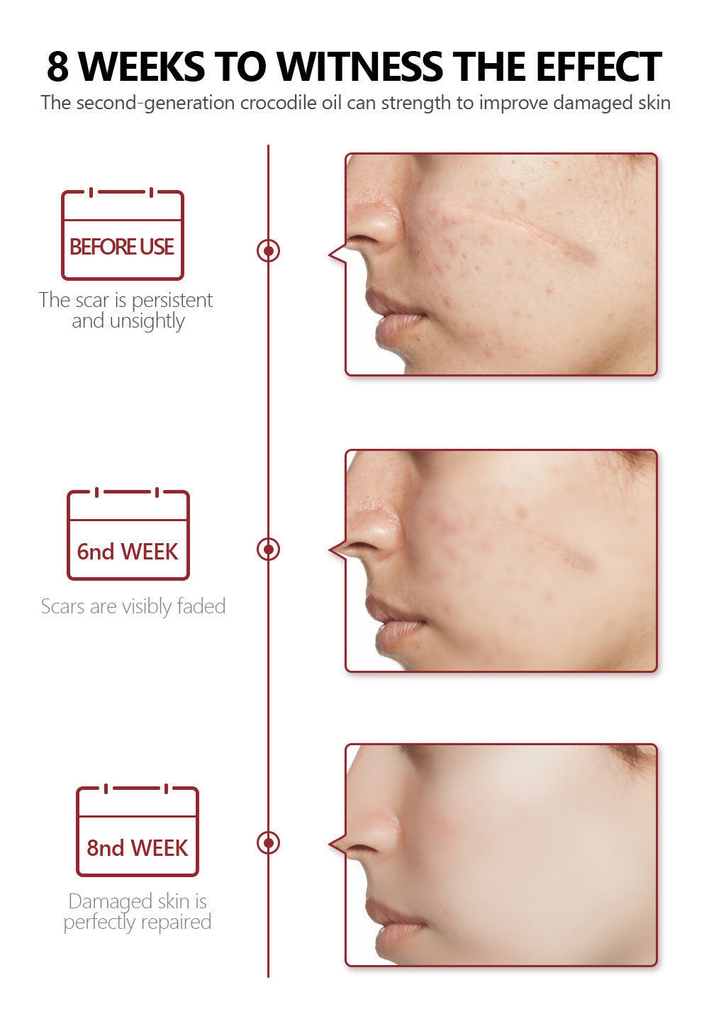 Riparazione della pelle Trattamento curativo Acne Cicatrici cheloidi Rimozione cicatrici